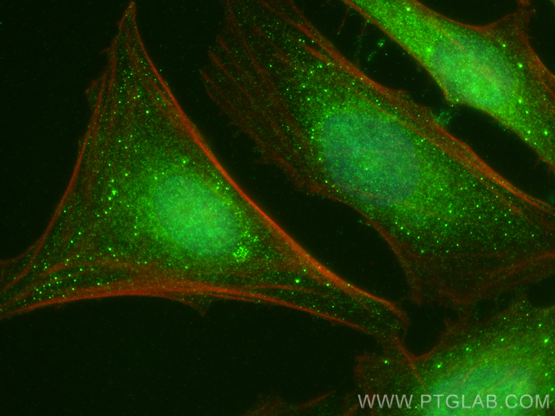 Immunofluorescence (IF) / fluorescent staining of HeLa cells using RPUSD1 Polyclonal antibody (25578-1-AP)