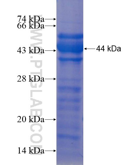 RPUSD1 fusion protein Ag22314 SDS-PAGE