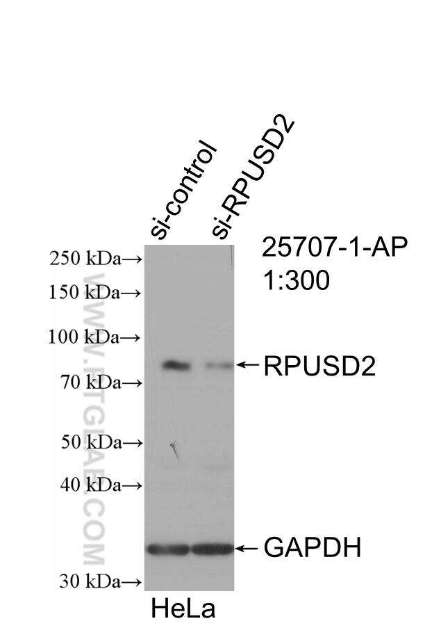 Western Blot (WB) analysis of HeLa cells using RPUSD2 Polyclonal antibody (25707-1-AP)