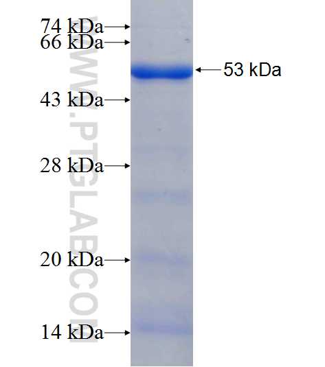 RPUSD2 fusion protein Ag22452 SDS-PAGE