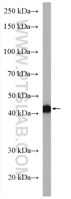 Western Blot (WB) analysis of mouse liver tissue using RPUSD4 Polyclonal antibody (27843-1-AP)
