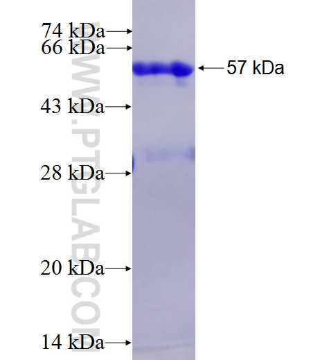 RPUSD4 fusion protein Ag27225 SDS-PAGE