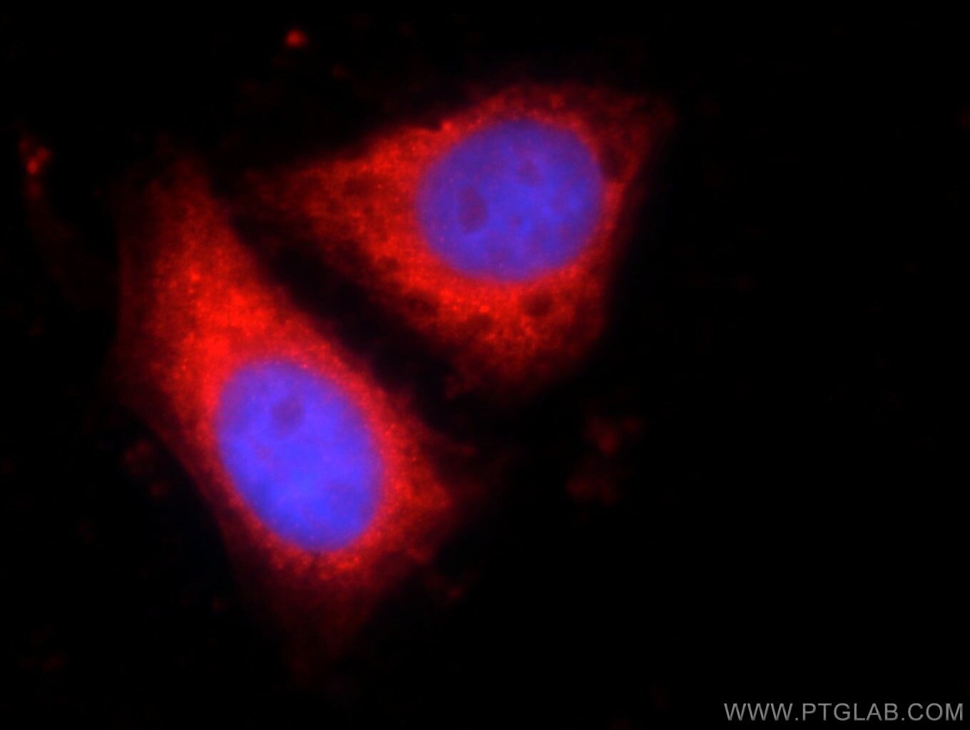 IF Staining of HepG2 using 22503-1-AP