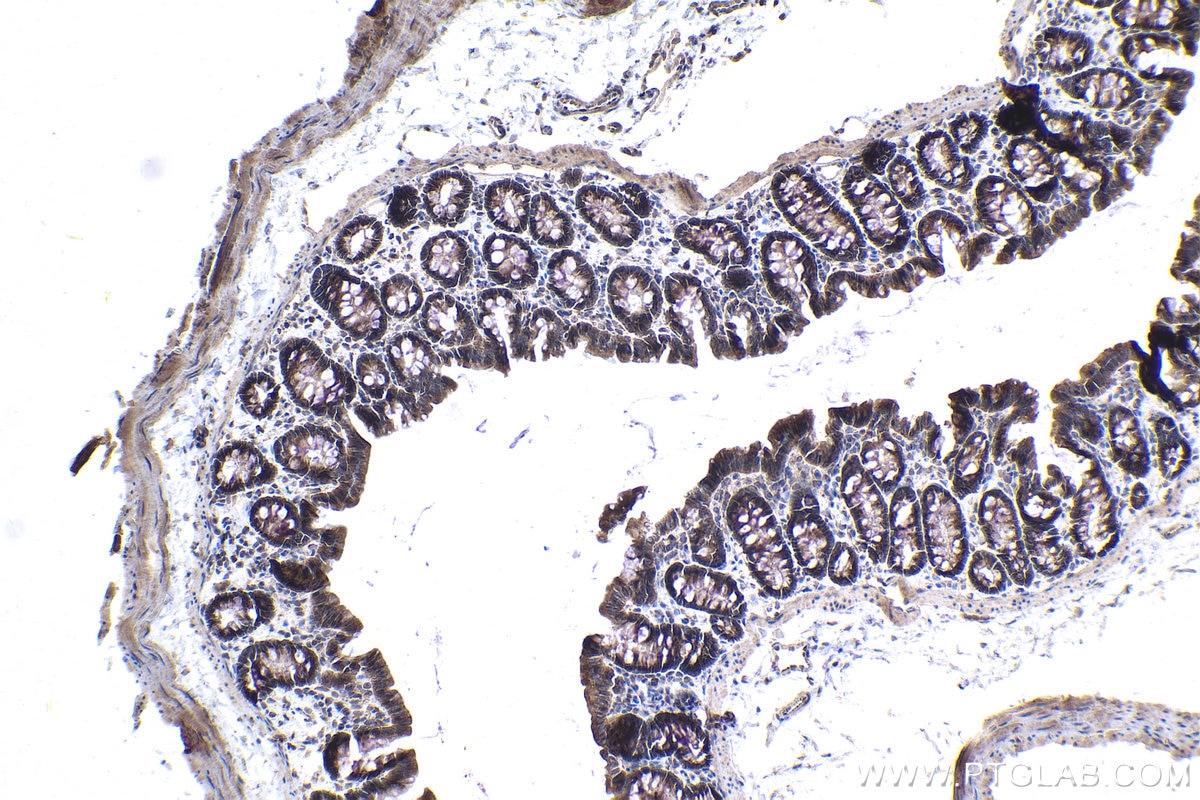 Immunohistochemistry (IHC) staining of rat colon tissue using CNOT9 Polyclonal antibody (22503-1-AP)