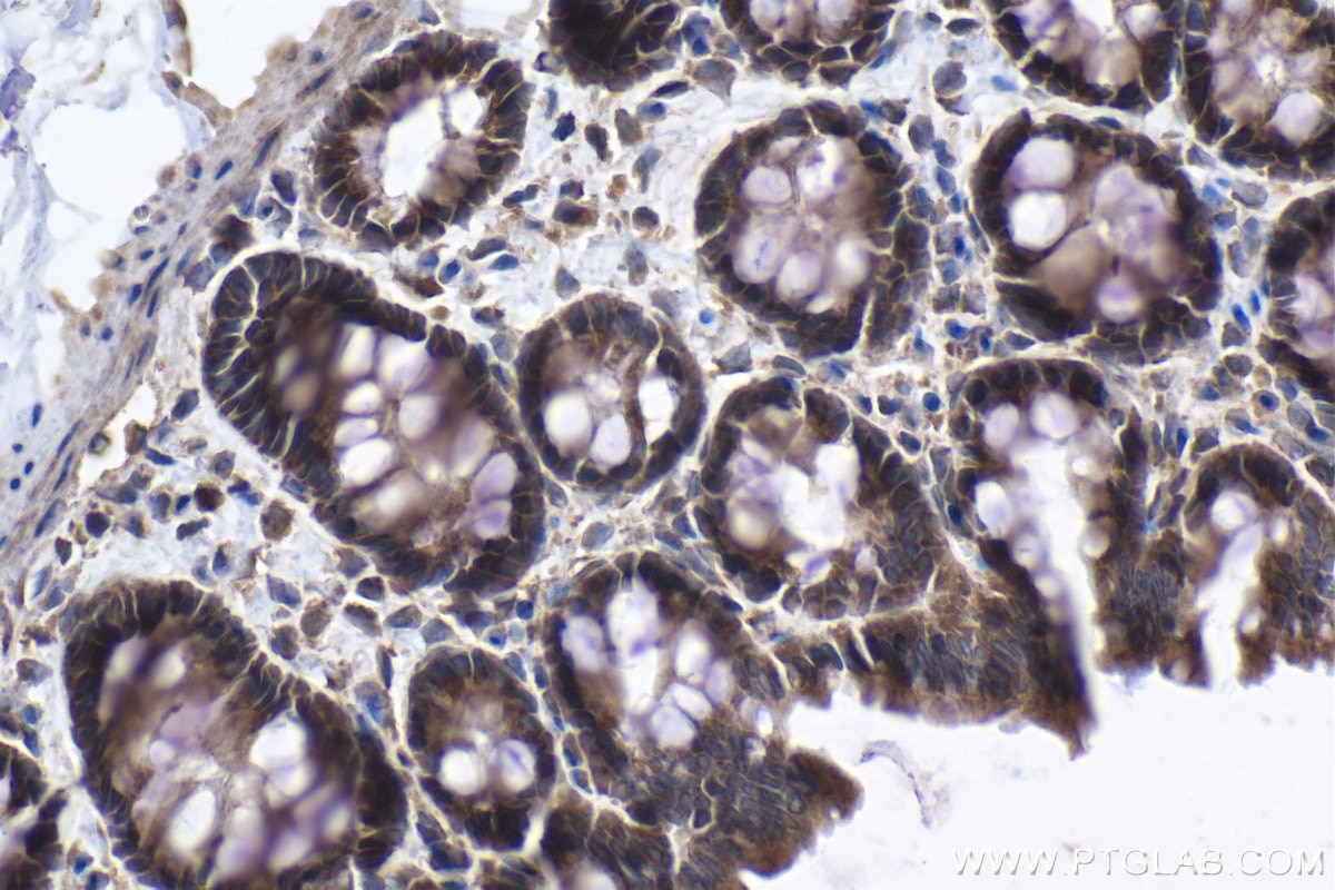 Immunohistochemistry (IHC) staining of rat colon tissue using CNOT9 Polyclonal antibody (22503-1-AP)