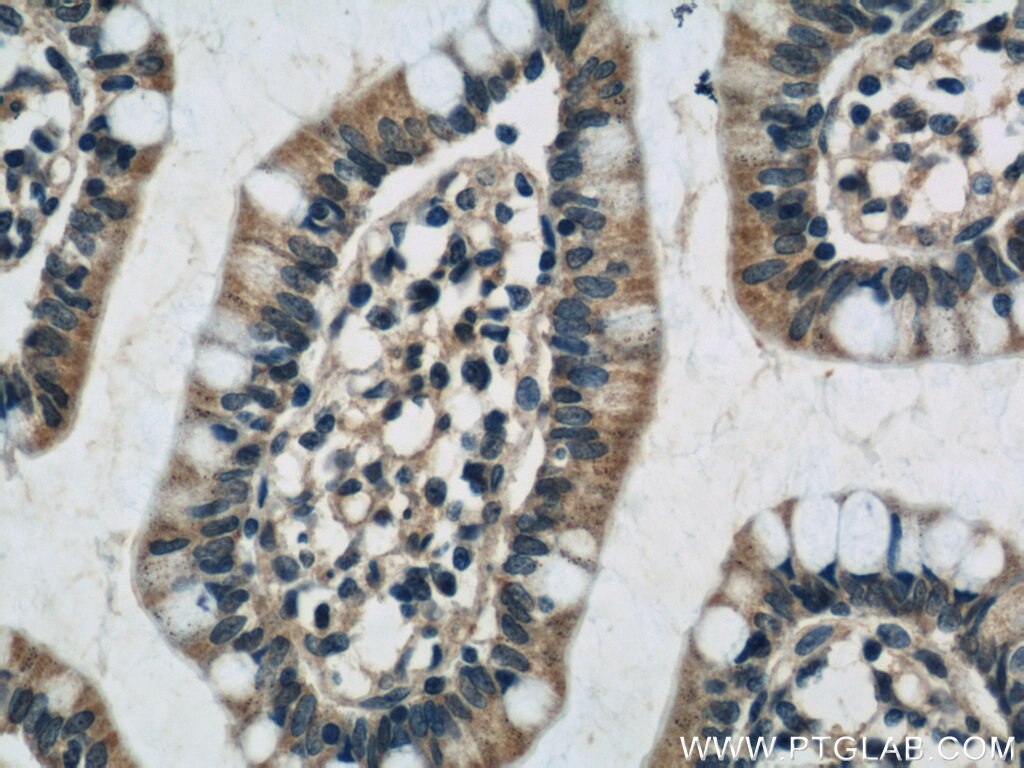 Immunohistochemistry (IHC) staining of human small intestine tissue using CNOT9 Polyclonal antibody (22503-1-AP)