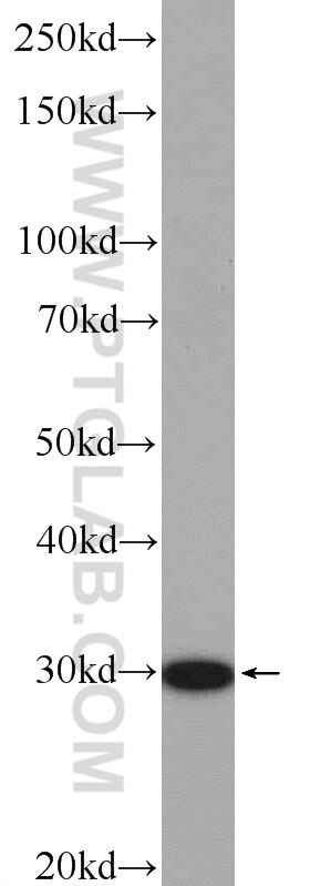 Western Blot (WB) analysis of MCF-7 cells using CNOT9 Polyclonal antibody (22503-1-AP)