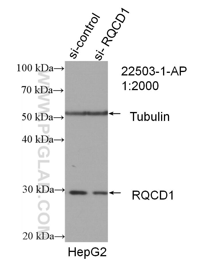 Western Blot (WB) analysis of HepG2 cells using CNOT9 Polyclonal antibody (22503-1-AP)