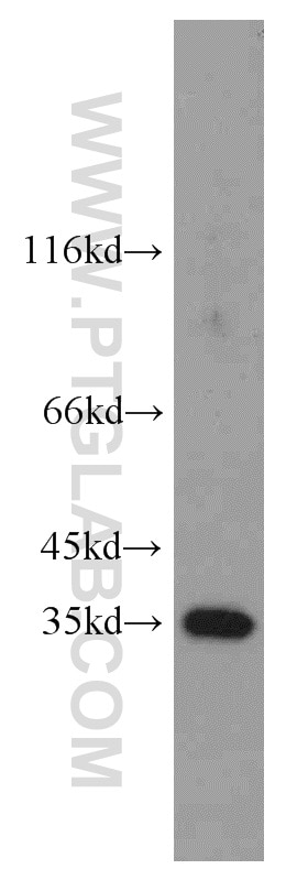 Western Blot (WB) analysis of HepG2 cells using CNOT9 Polyclonal antibody (22503-1-AP)