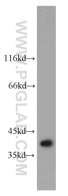 Western Blot (WB) analysis of mouse thymus tissue using CNOT9 Polyclonal antibody (22503-1-AP)