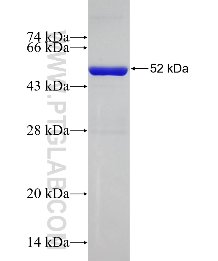 RQCD1 fusion protein Ag18197 SDS-PAGE