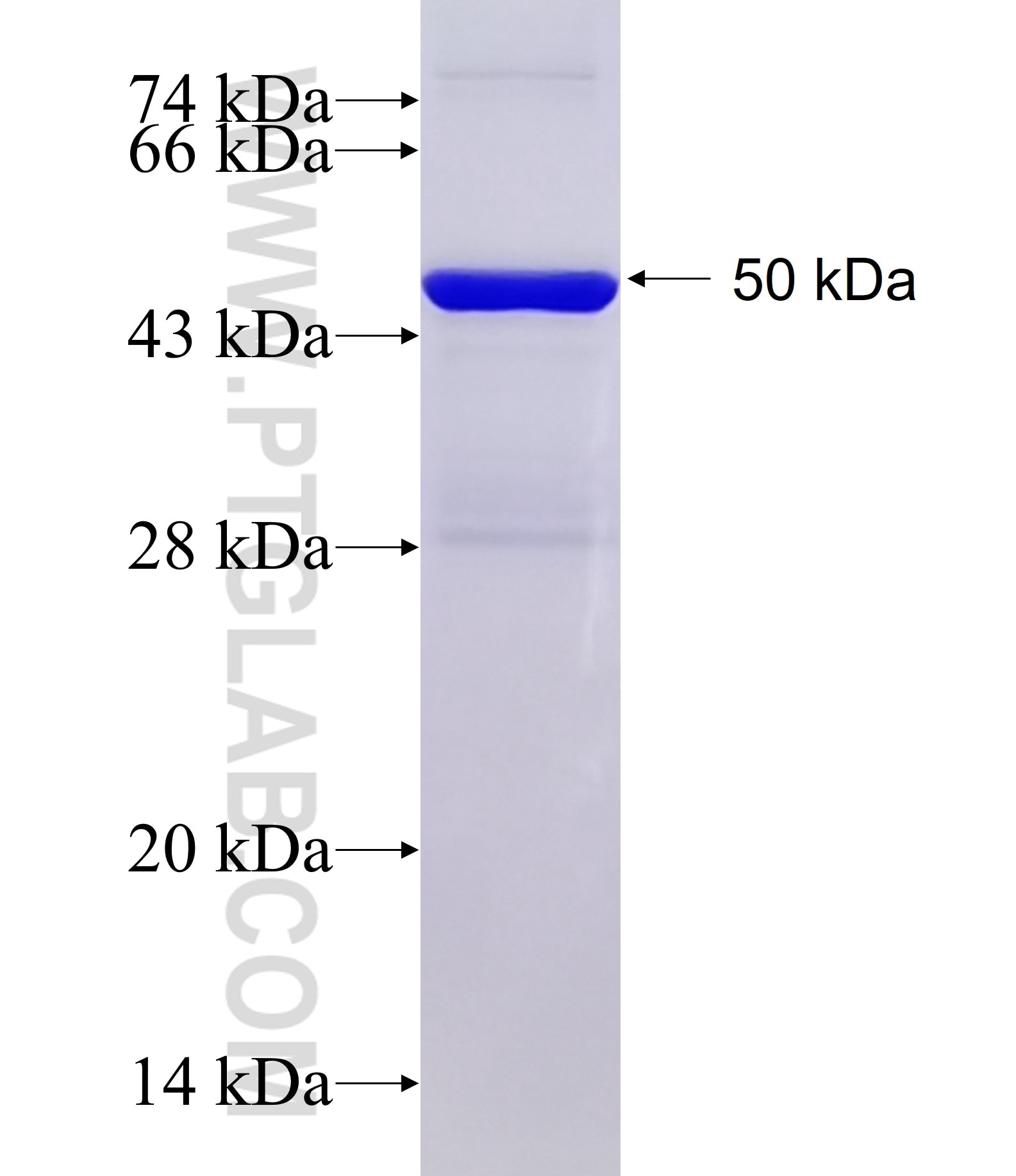 RQCD1 fusion protein Ag18197 SDS-PAGE