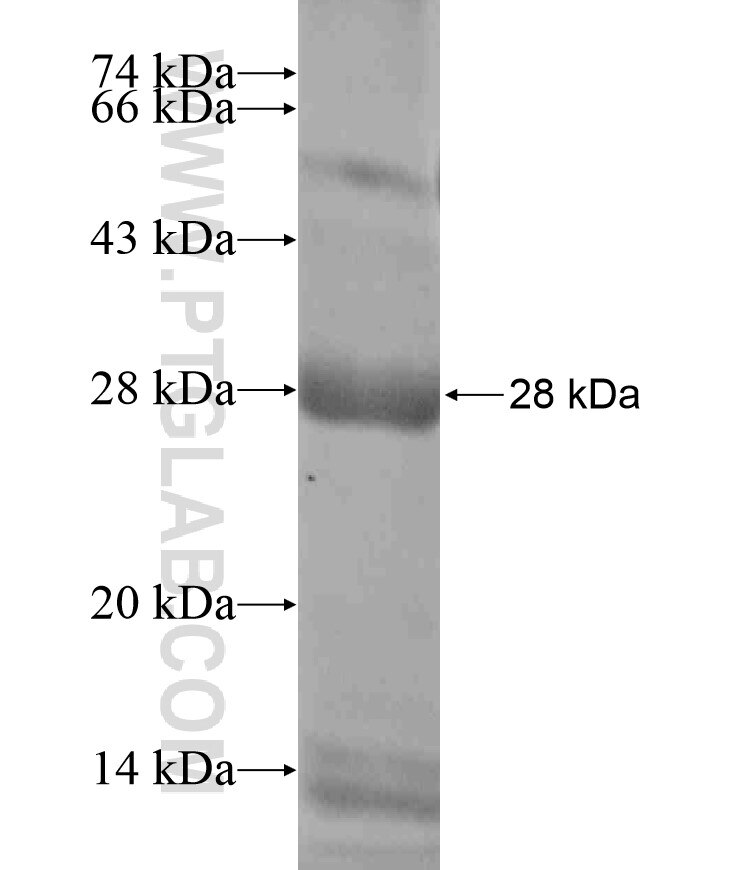 RQCD1 fusion protein Ag18507 SDS-PAGE