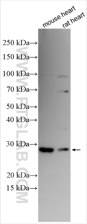 Western Blot (WB) analysis of various lysates using RRAD Polyclonal antibody (27763-1-AP)