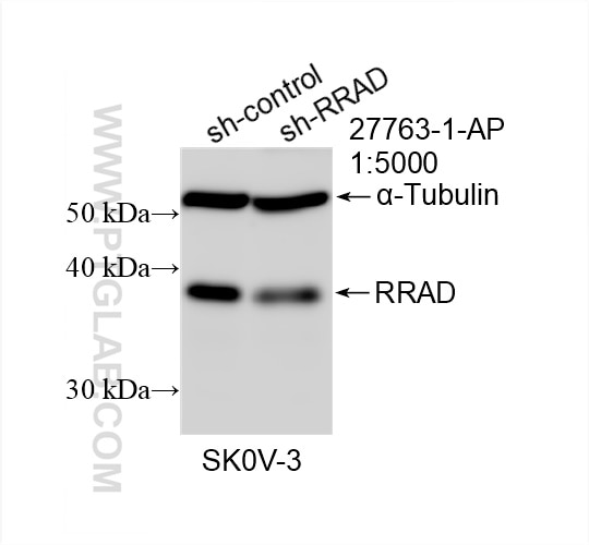 Western Blot (WB) analysis of SKOV-3 cells using RRAD Polyclonal antibody (27763-1-AP)