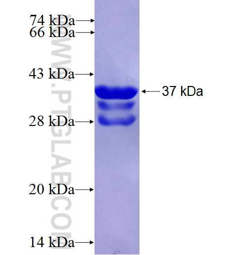 RRAD fusion protein Ag26869 SDS-PAGE