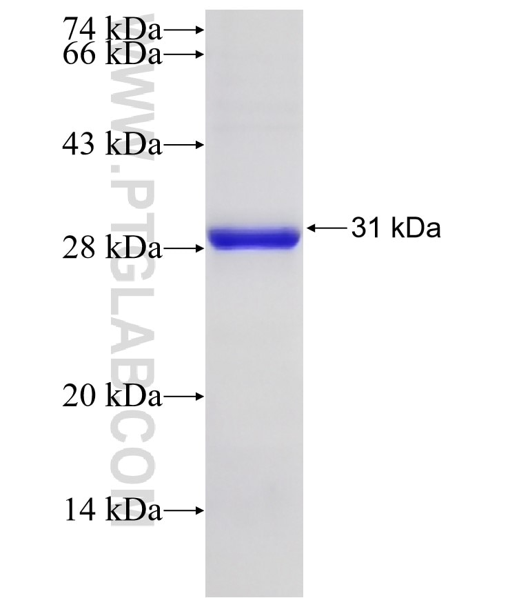 RRAGA fusion protein Ag25872 SDS-PAGE