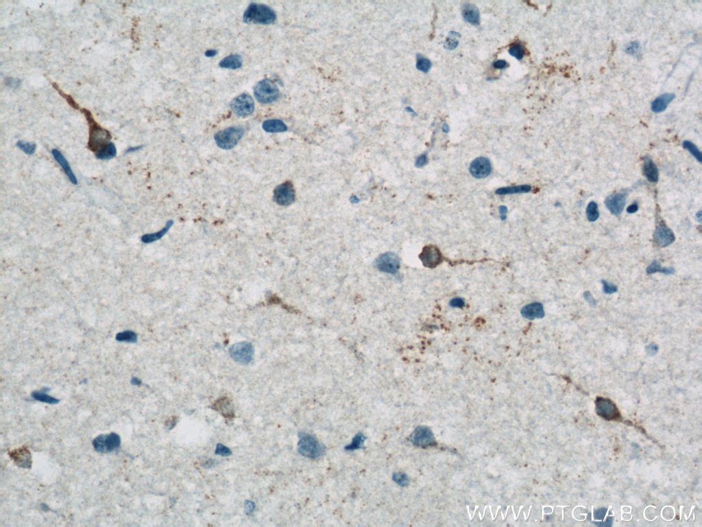 Immunohistochemistry (IHC) staining of human brain tissue using RRAGB Polyclonal antibody (13023-1-AP)