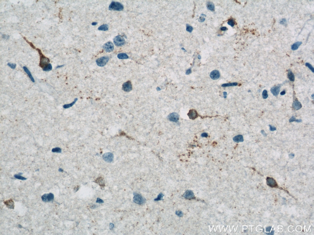 IHC staining of human brain using 13023-1-AP