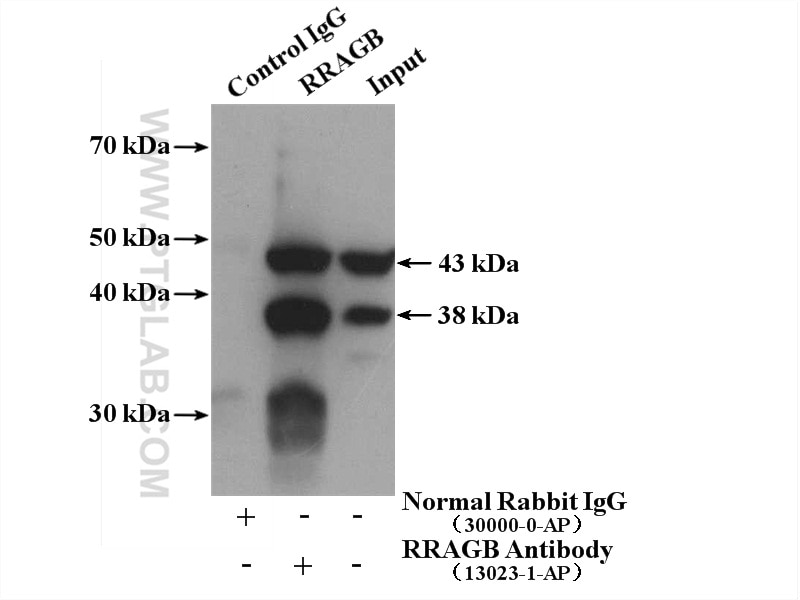 Immunoprecipitation (IP) experiment of mouse testis tissue using RRAGB Polyclonal antibody (13023-1-AP)