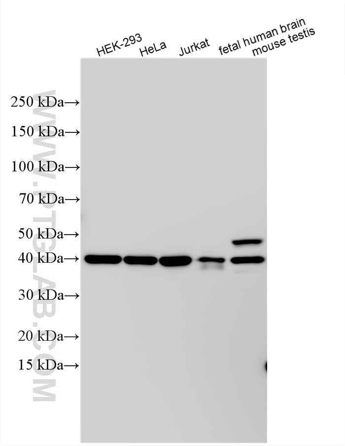 Western Blot (WB) analysis of various lysates using RRAGB Polyclonal antibody (13023-1-AP)