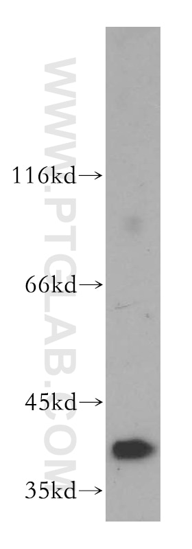 Western Blot (WB) analysis of human testis tissue using RRAGB Polyclonal antibody (13023-1-AP)