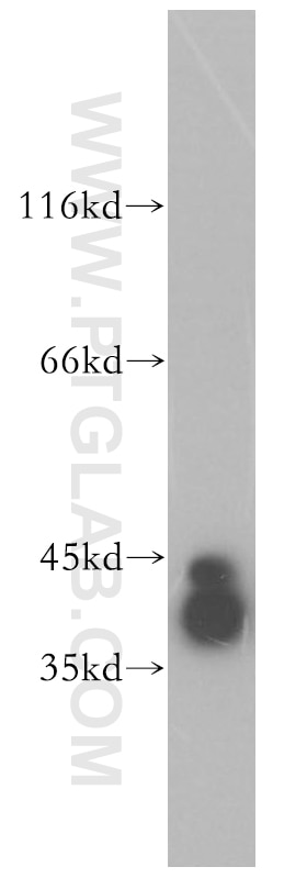Western Blot (WB) analysis of human brain tissue using RRAGB Polyclonal antibody (13023-1-AP)