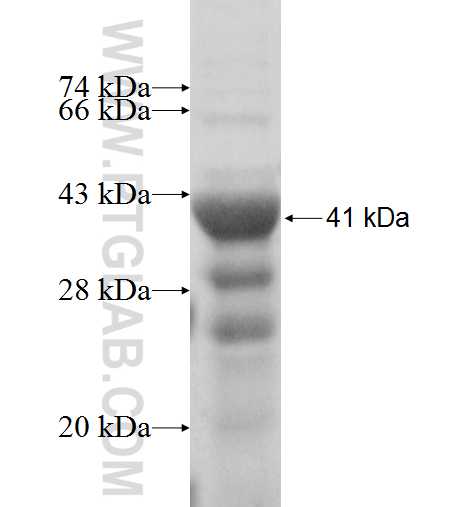 RRAGB fusion protein Ag4116 SDS-PAGE