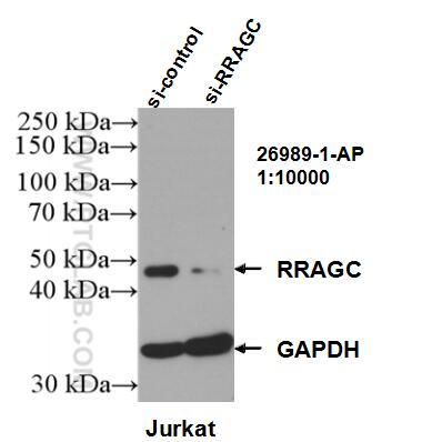 Western Blot (WB) analysis of Jurkat cells using RRAGC Polyclonal antibody (26989-1-AP)