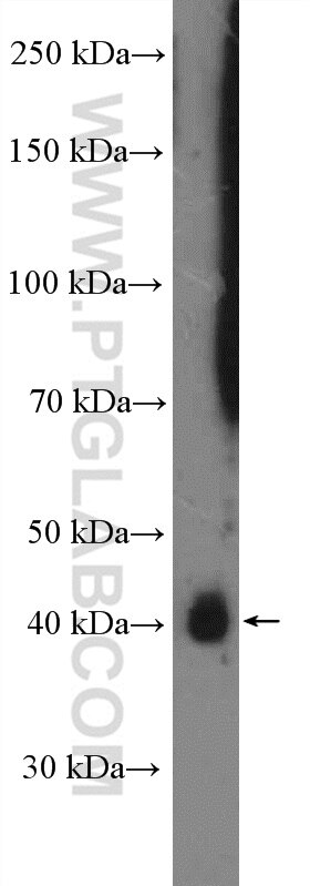 WB analysis of HeLa using 26989-1-AP