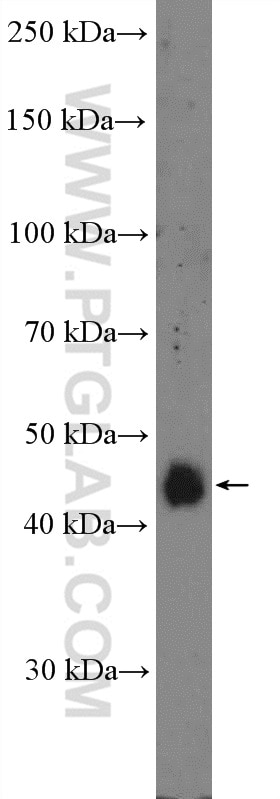 Western Blot (WB) analysis of Jurkat cells using RRAGC Polyclonal antibody (26989-1-AP)