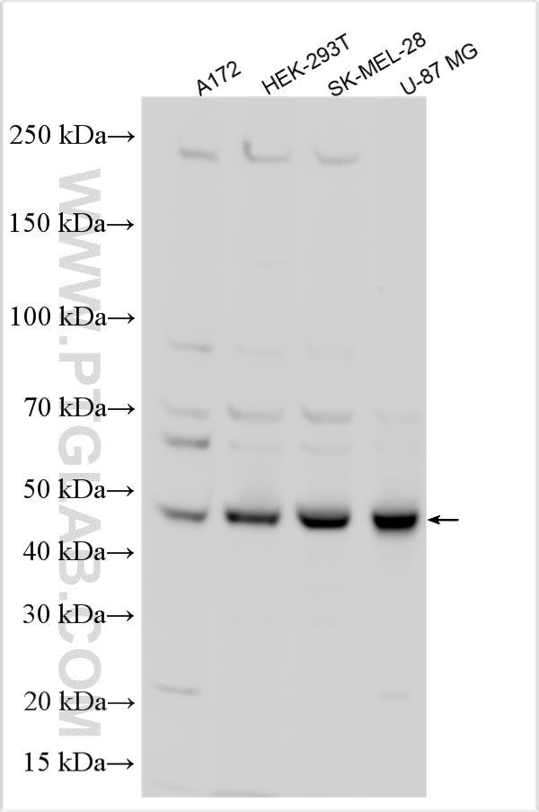 WB analysis using 15315-1-AP Western Blot (WB) analysis of various lysates using RRAGD Polyclonal antibody (15315-1-AP)