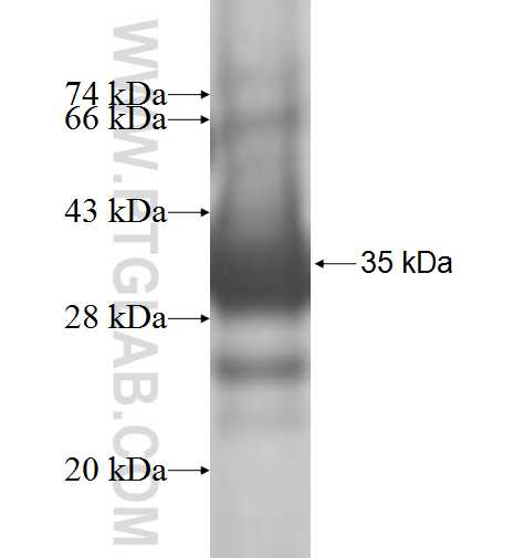 RRAGD fusion protein Ag7973 SDS-PAGE