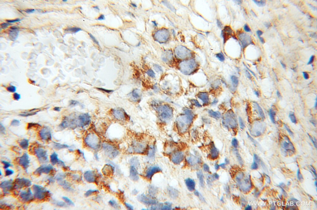 RRAS Polyclonal antibody