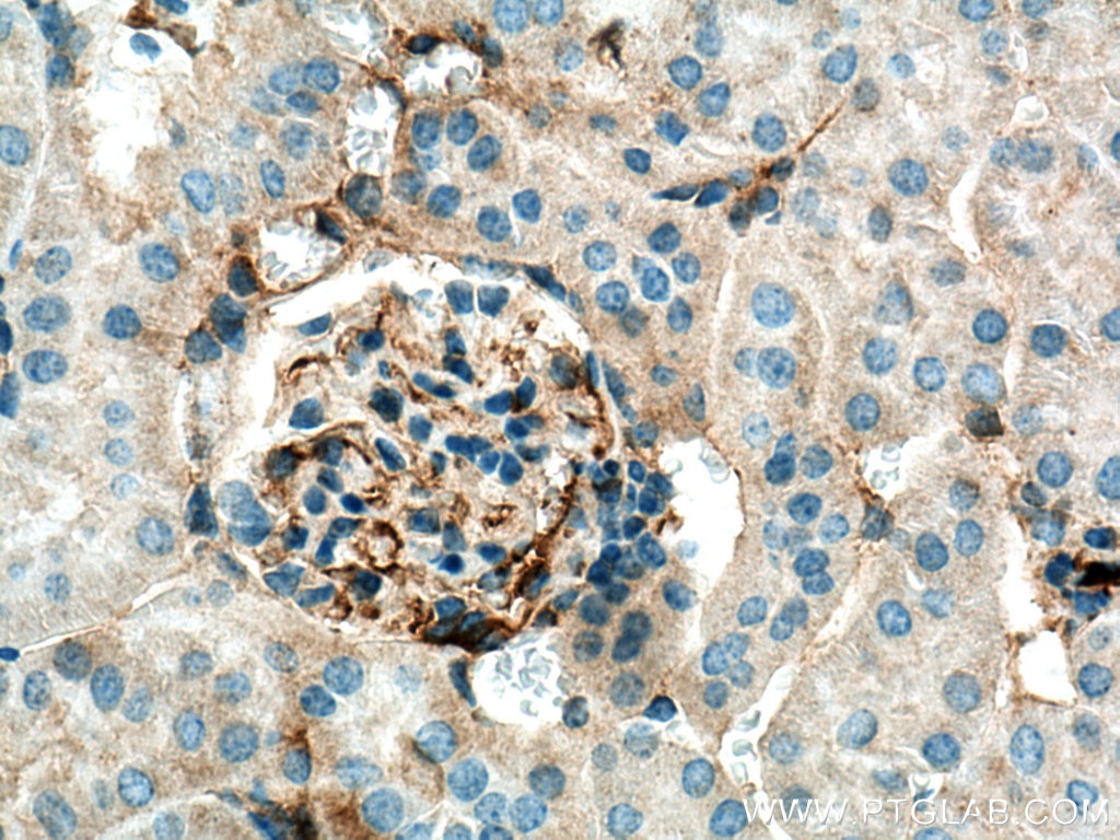 Immunohistochemistry (IHC) staining of mouse kidney tissue using RRAS Polyclonal antibody (27457-1-AP)