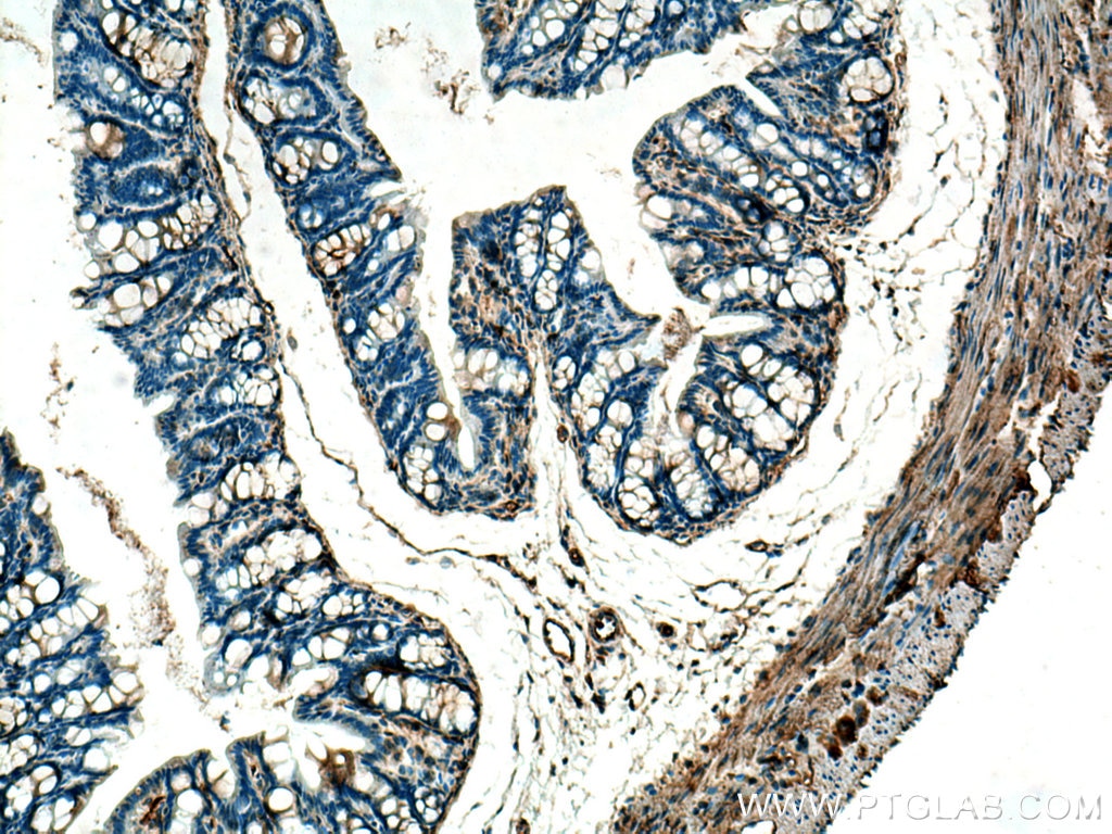 Immunohistochemistry (IHC) staining of mouse colon tissue using RRAS Polyclonal antibody (27457-1-AP)