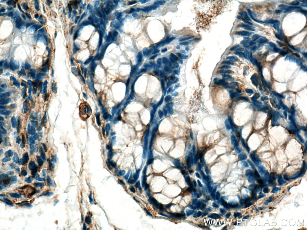 Immunohistochemistry (IHC) staining of mouse colon tissue using RRAS Polyclonal antibody (27457-1-AP)