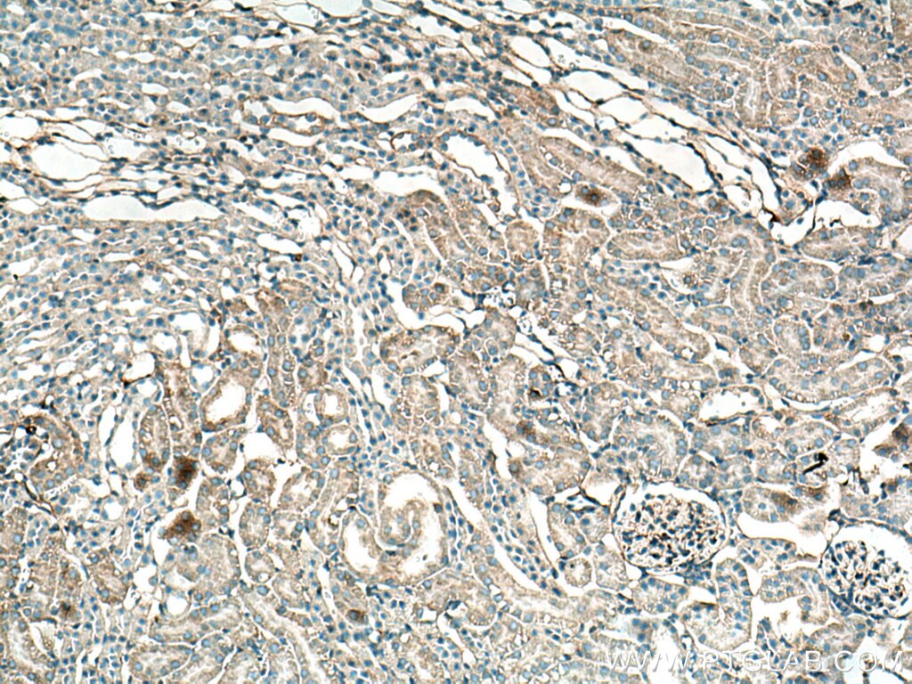 Immunohistochemistry (IHC) staining of mouse kidney tissue using RRAS Polyclonal antibody (27457-1-AP)