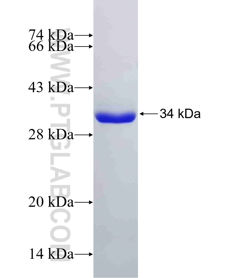 RRAS fusion protein Ag25109 SDS-PAGE