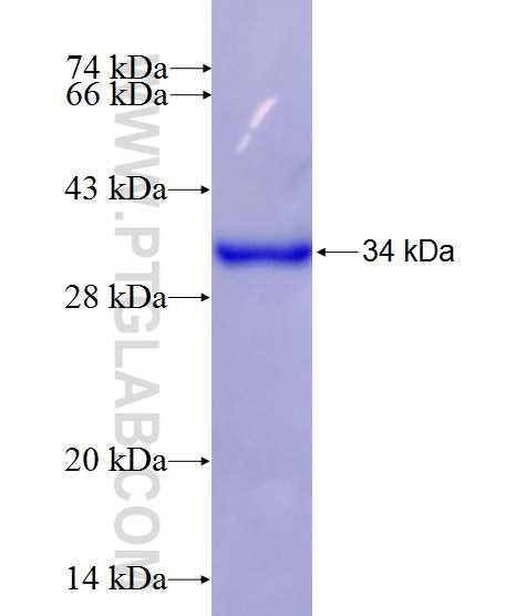 RRAS fusion protein Ag26538 SDS-PAGE