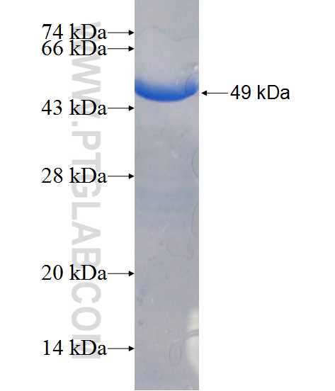RRAS fusion protein Ag2246 SDS-PAGE