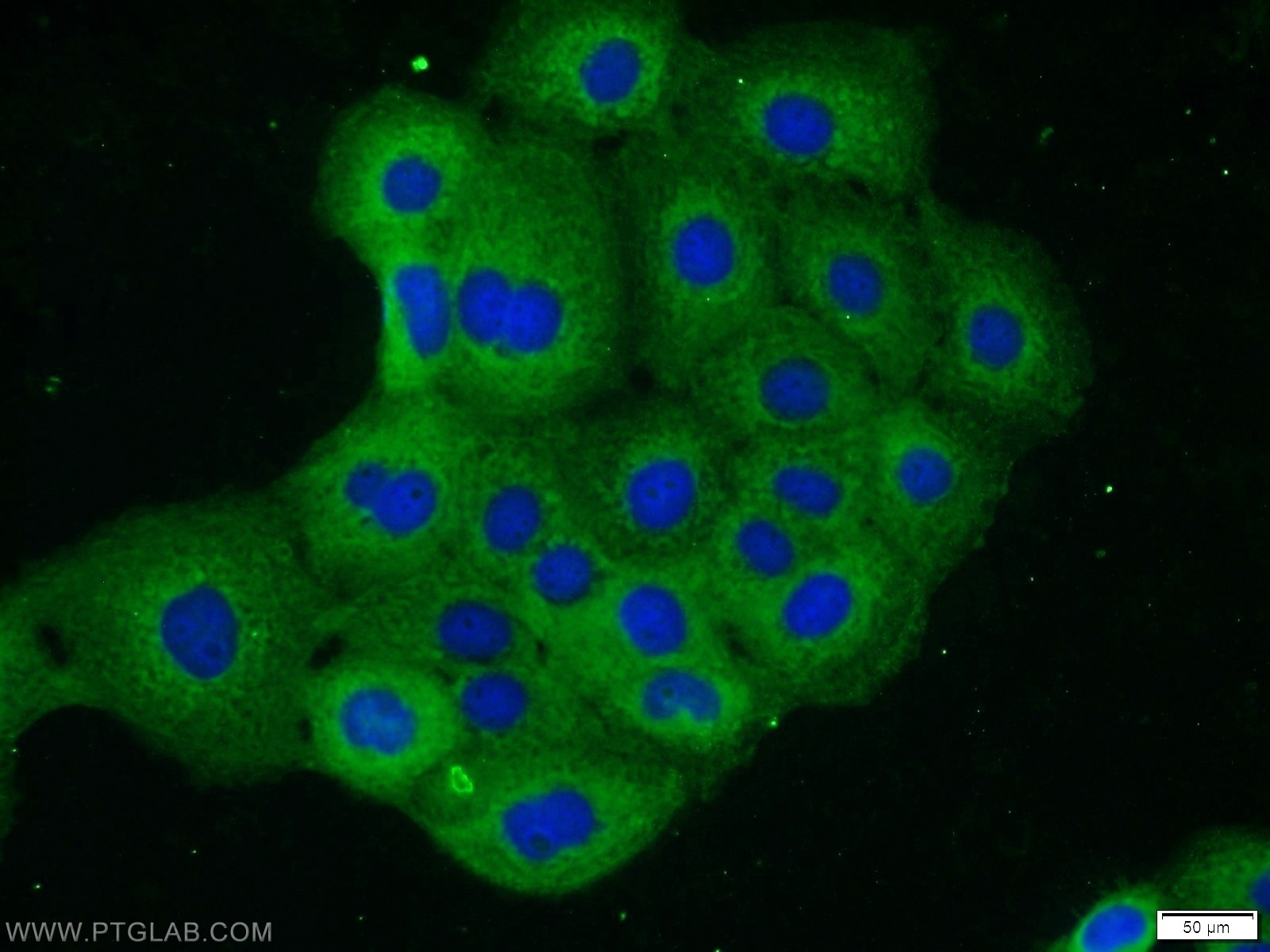 Immunofluorescence (IF) / fluorescent staining of A431 cells using RRAS2 Polyclonal antibody (12530-1-AP)