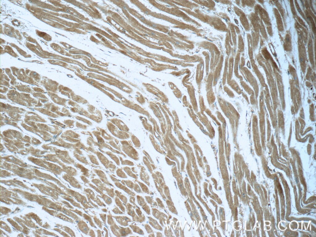 IHC staining of human heart using 12530-1-AP