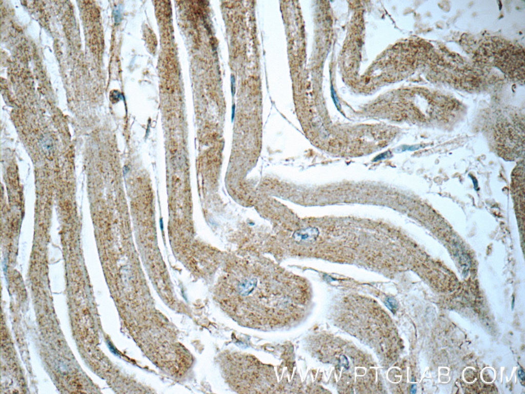 IHC staining of human heart using 12530-1-AP