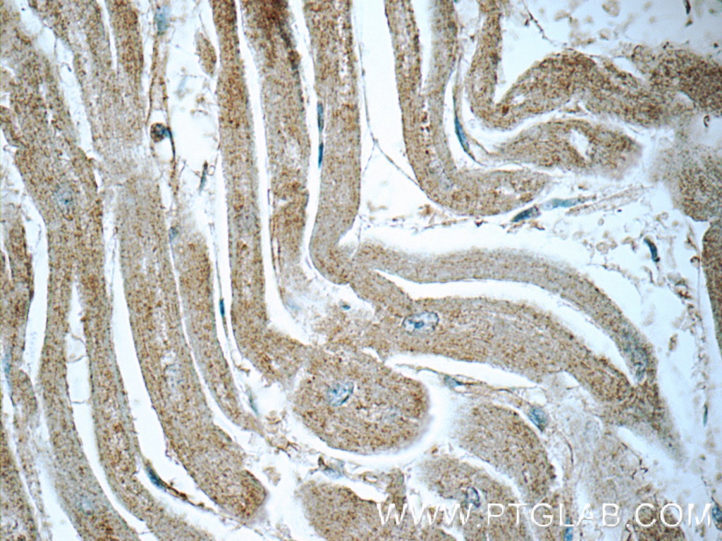 Immunohistochemistry (IHC) staining of human heart tissue using RRAS2 Polyclonal antibody (12530-1-AP)