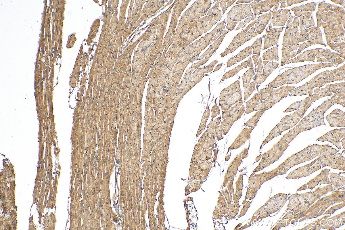 Immunohistochemistry (IHC) staining of mouse heart tissue using RRAS2 Polyclonal antibody (12530-1-AP)