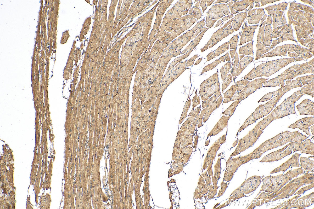 IHC staining of mouse heart using 12530-1-AP