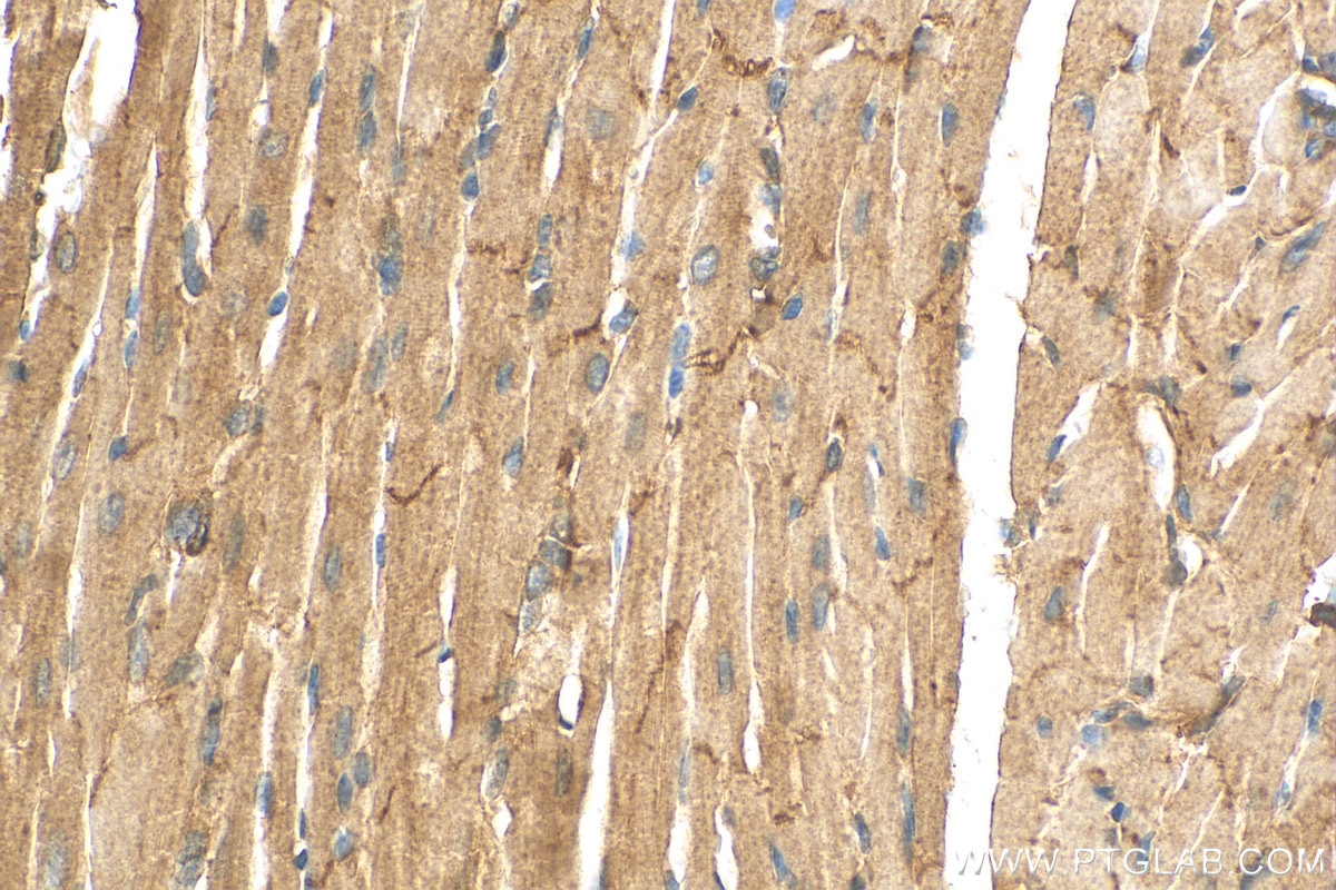 Immunohistochemistry (IHC) staining of mouse heart tissue using RRAS2 Polyclonal antibody (12530-1-AP)