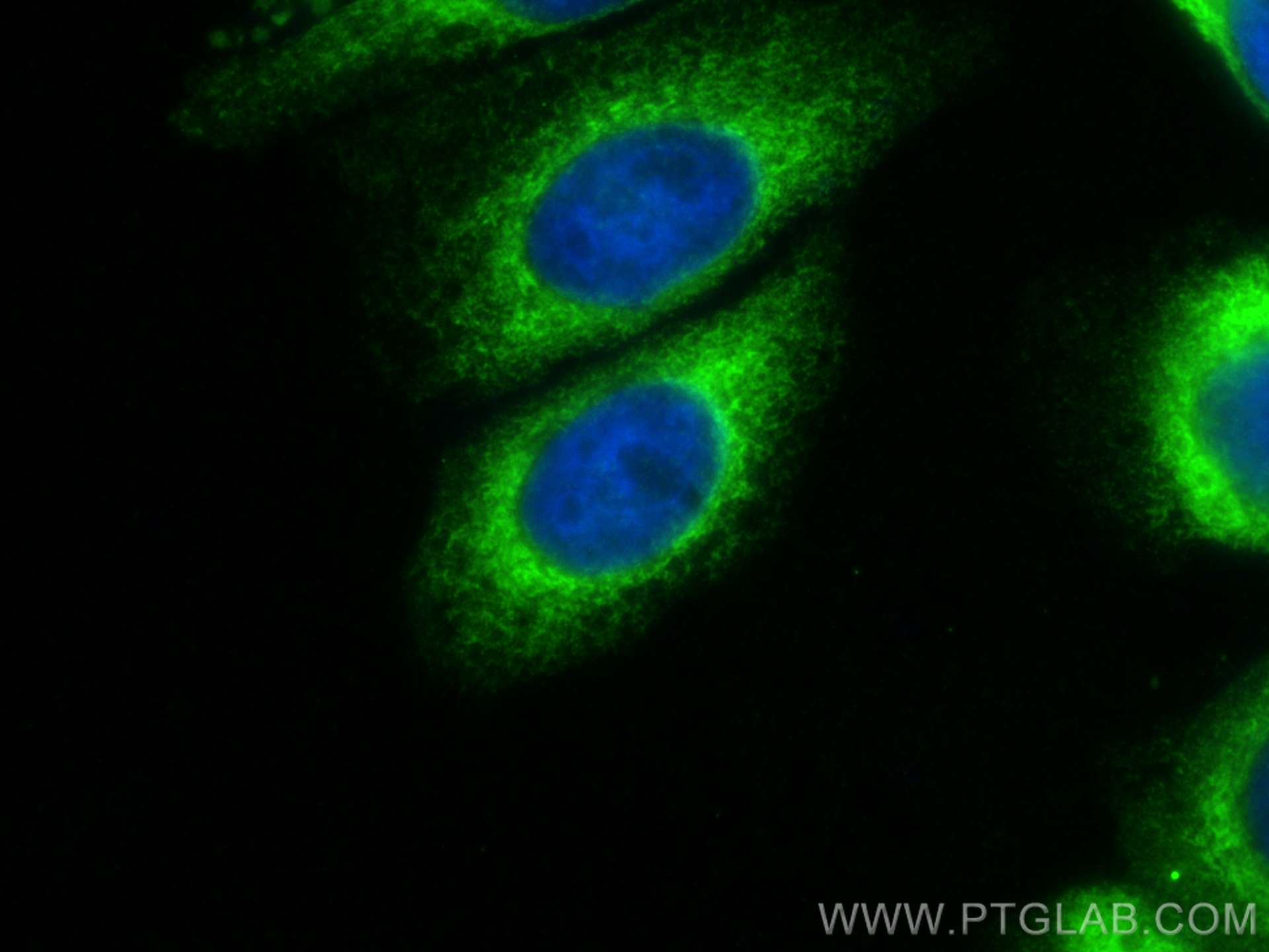 Immunofluorescence (IF) / fluorescent staining of HepG2 cells using RRBP1 Polyclonal antibody (22015-1-AP)
