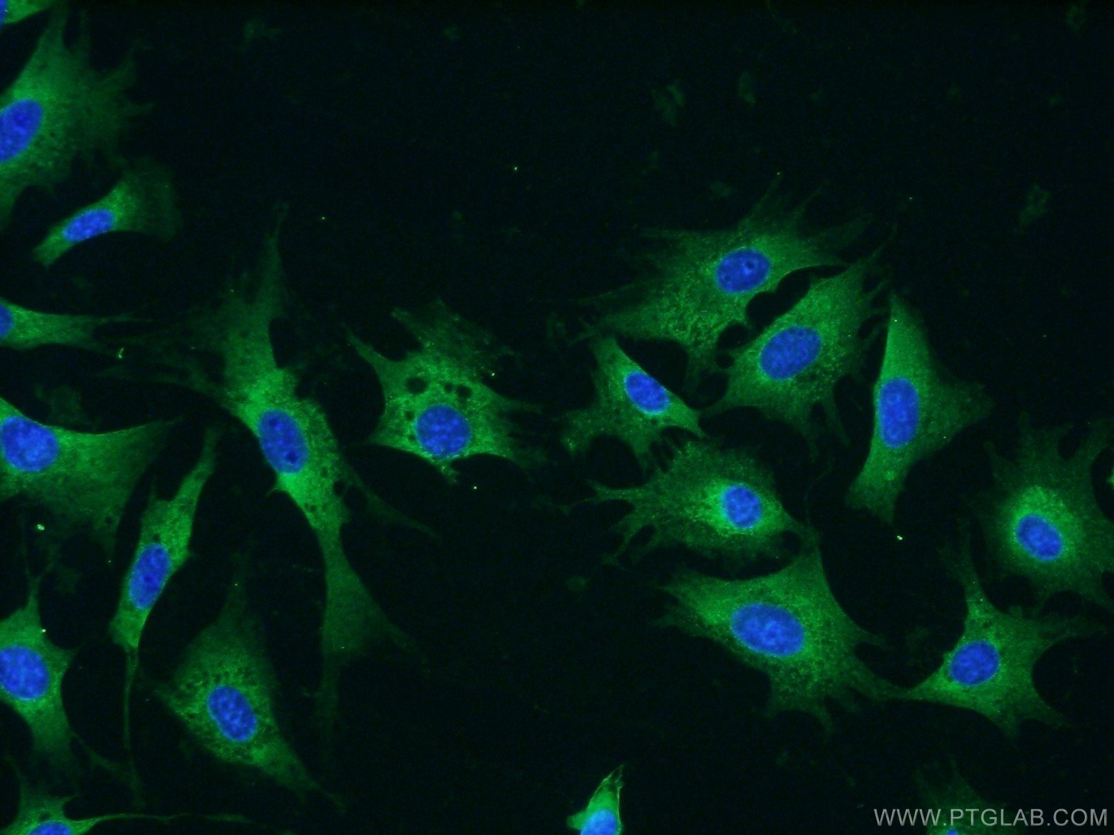 Immunofluorescence (IF) / fluorescent staining of NIH/3T3 cells using RRBP1 Polyclonal antibody (22015-1-AP)